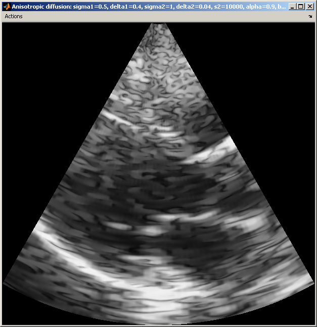 Anisotrop diffusion (klicka fr att toggla)