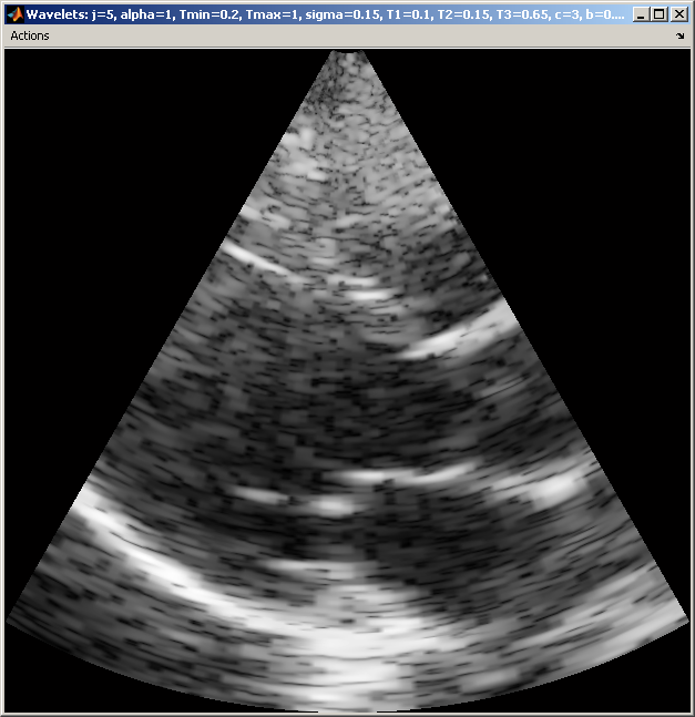 Wavelets (klicka fr att toggla)